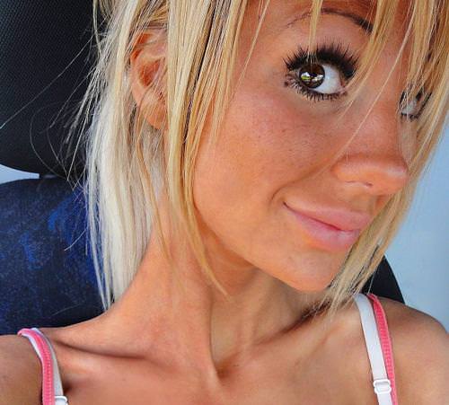 21 yaşında estetik faciası