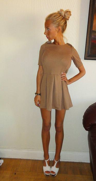 21 yaşında estetik faciası