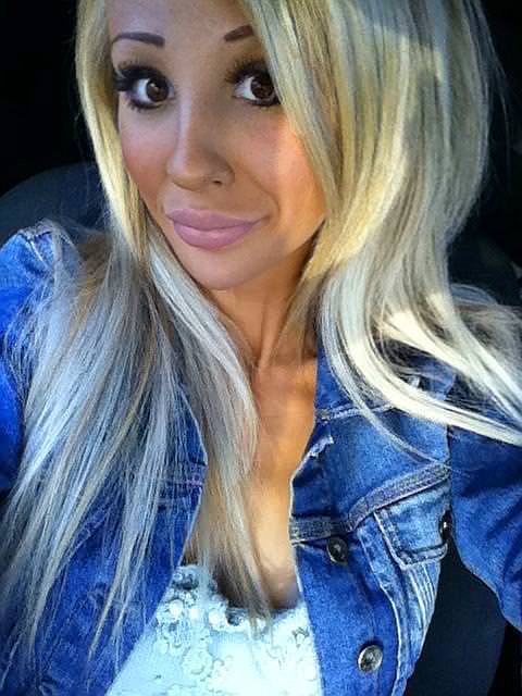 21 yaşında estetik faciası