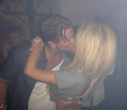 21 yaşında estetik faciası