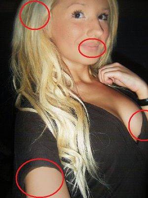 21 yaşında estetik faciası