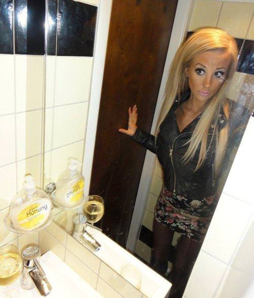 21 yaşında estetik faciası