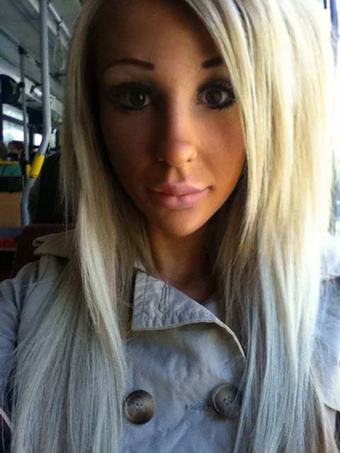 21 yaşında estetik faciası