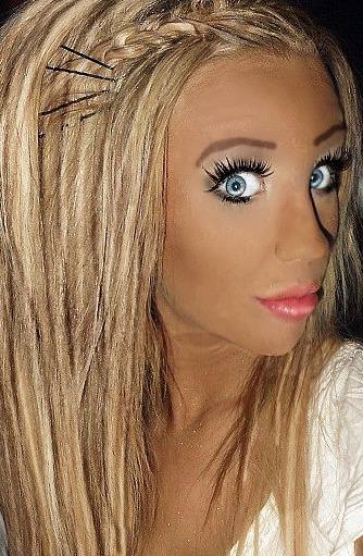 21 yaşında estetik faciası