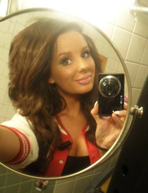 21 yaşında estetik faciası