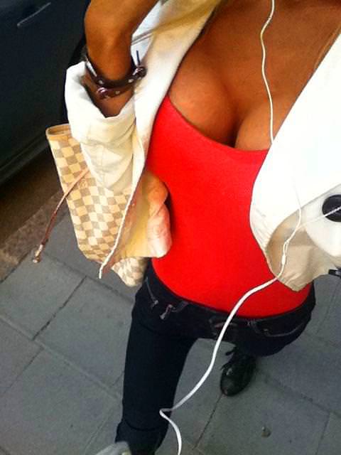 21 yaşında estetik faciası