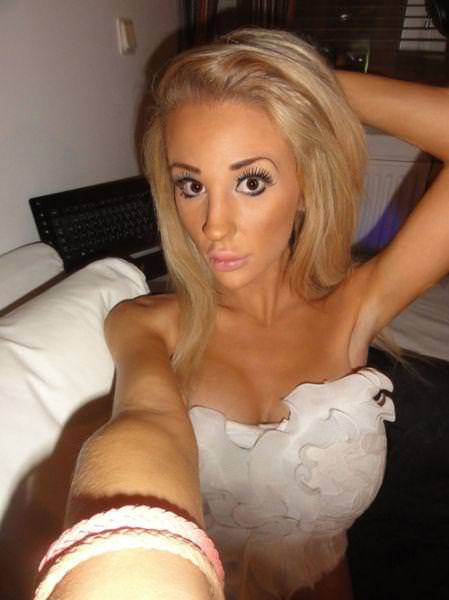 21 yaşında estetik faciası