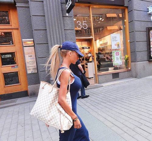 21 yaşında estetik faciası