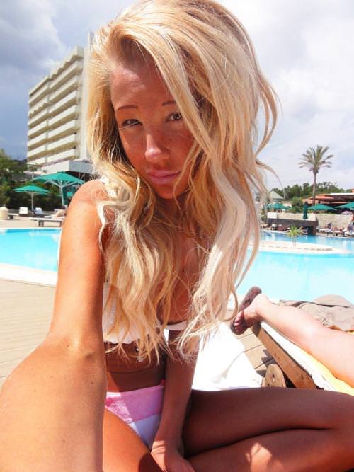 21 yaşında estetik faciası