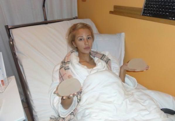 21 yaşında estetik faciası