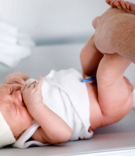 Göbek bağı bakımı