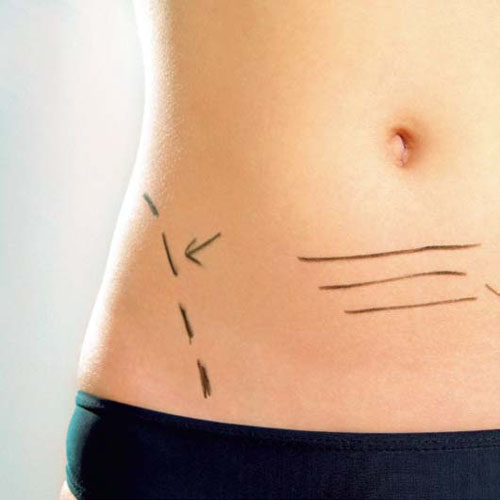 Düz karın ince bel her kadının hayalidir