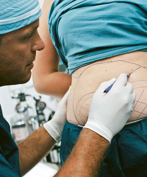 Düz karın ince bel her kadının hayalidir