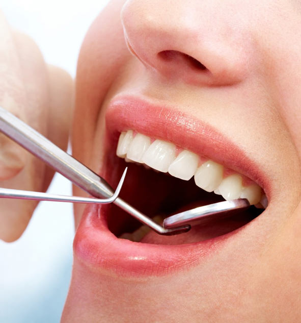 Diş beyazlatırken bunlara dikkat!