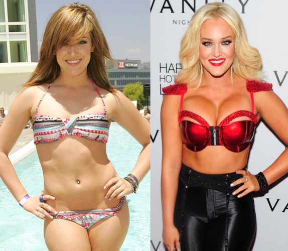 Estetik yaptıran ünlüler