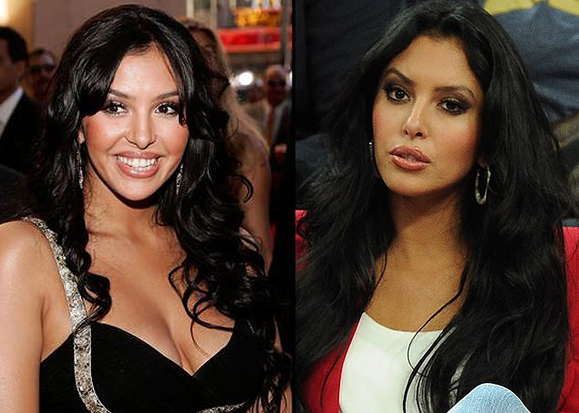 Estetik yaptıran ünlüler