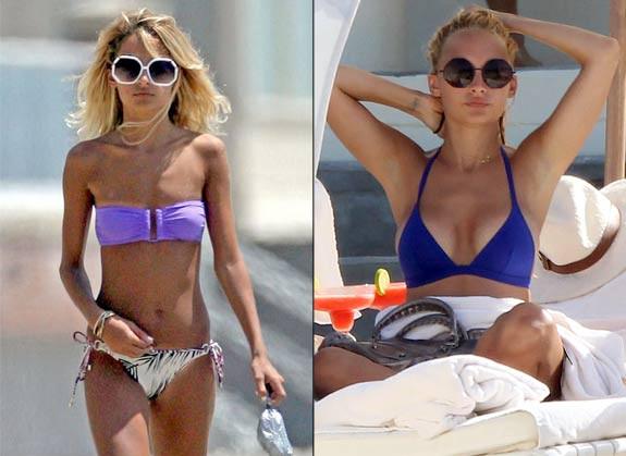 Estetik yaptıran ünlüler