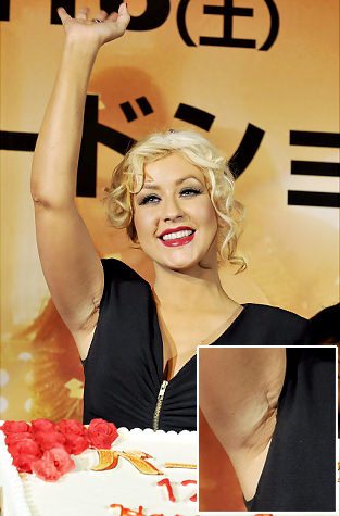 Estetik yaptıran ünlüler