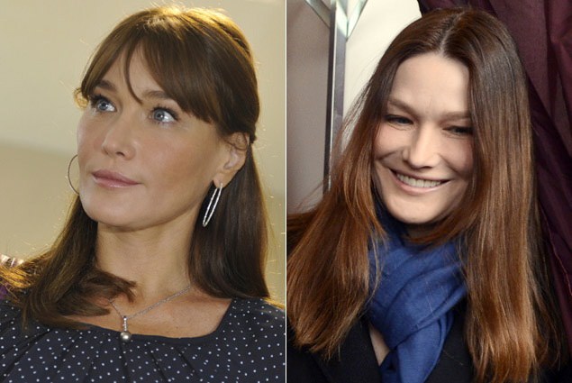 Estetik yaptıran ünlüler