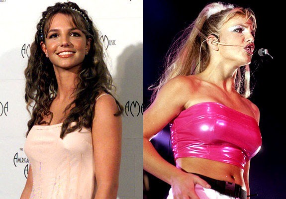 Estetik yaptıran ünlüler