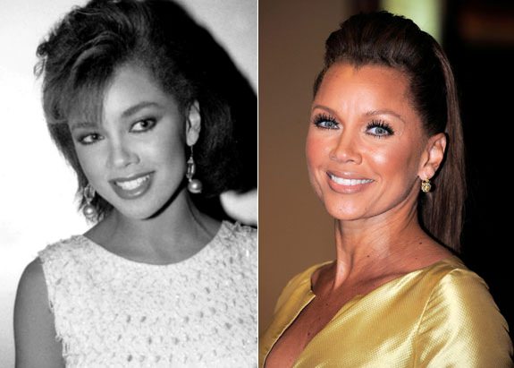 Estetik yaptıran ünlüler