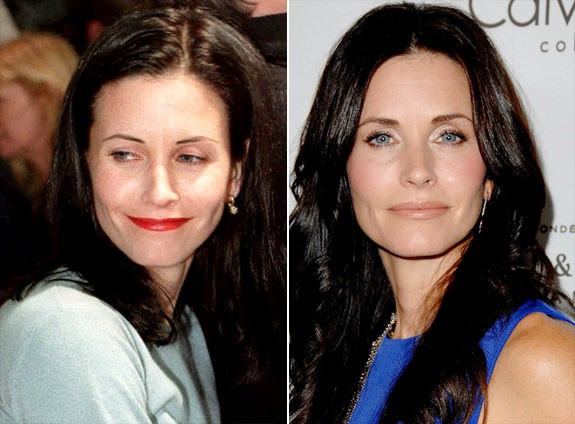 Estetik yaptıran ünlüler