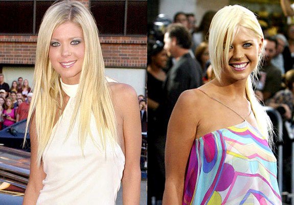 Estetik yaptıran ünlüler