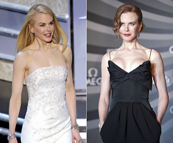 Estetik yaptıran ünlüler