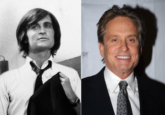 Estetik yaptıran ünlüler