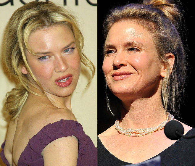 Renee Zellweger'in inanılmaz değişimi