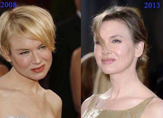Renee Zellweger'in inanılmaz değişimi
