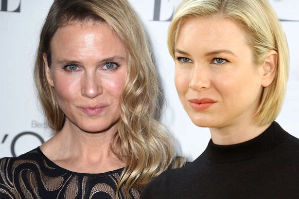Renee Zellweger'in inanılmaz değişimi