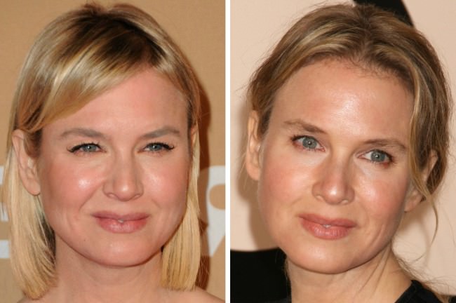 Renee Zellweger'in inanılmaz değişimi