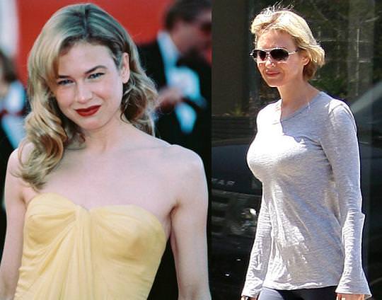 Renee Zellweger'in inanılmaz değişimi