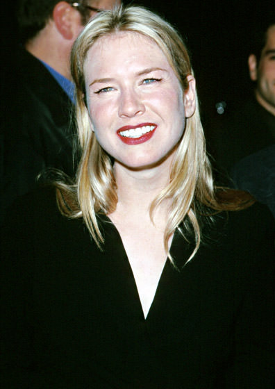 Renee Zellweger'in inanılmaz değişimi