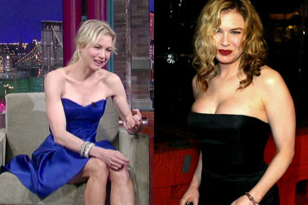 Renee Zellweger'in inanılmaz değişimi