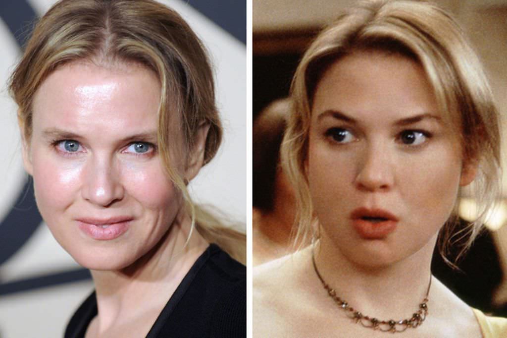 Renee Zellweger'in inanılmaz değişimi