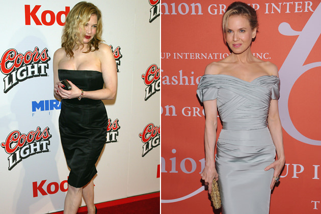 Renee Zellweger'in inanılmaz değişimi