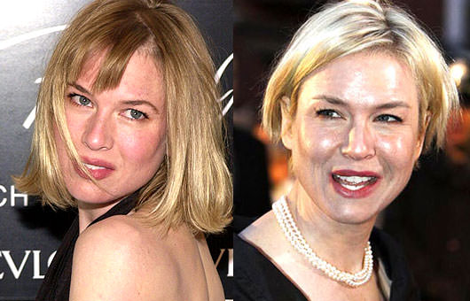 Renee Zellweger'in inanılmaz değişimi