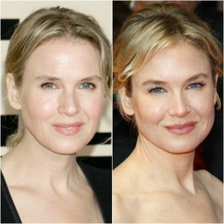 Renee Zellweger'in inanılmaz değişimi