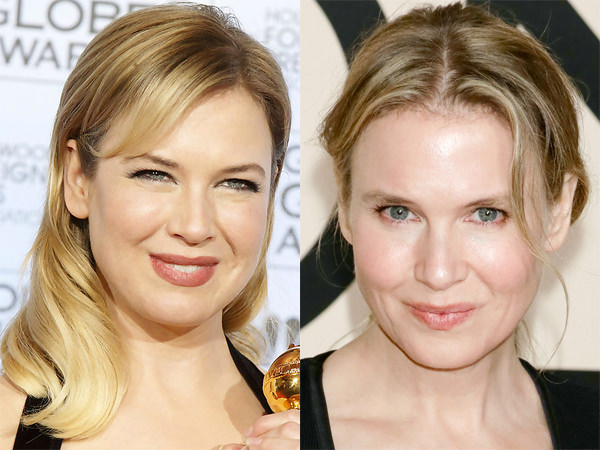 Renee Zellweger'in inanılmaz değişimi