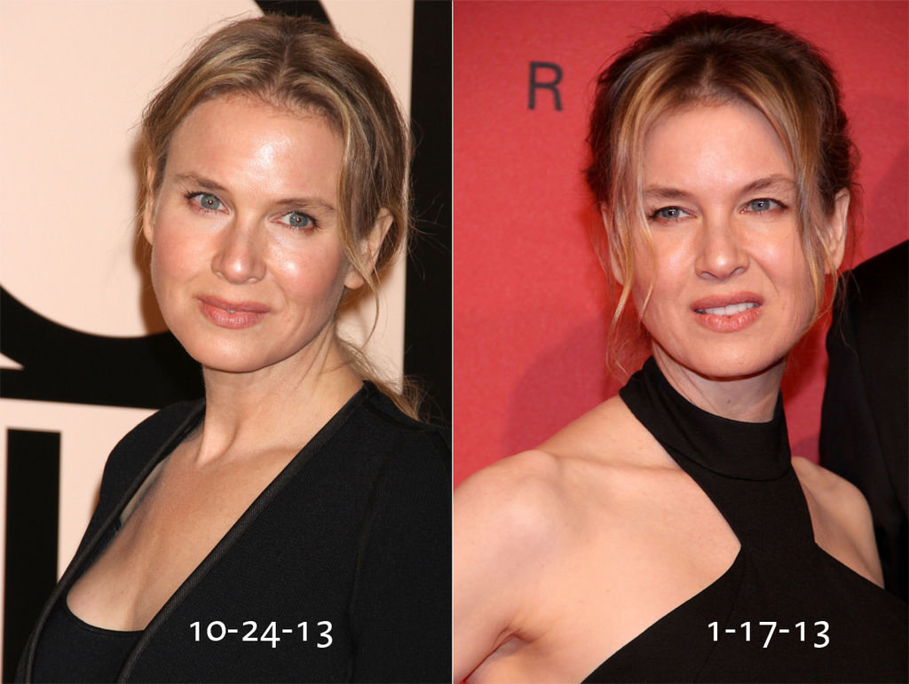Renee Zellweger'in inanılmaz değişimi