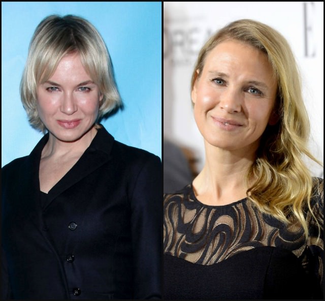 Renee Zellweger'in inanılmaz değişimi