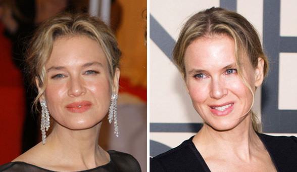 Renee Zellweger'in inanılmaz değişimi