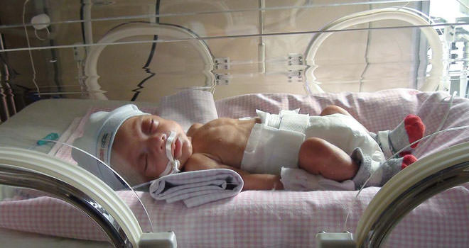 Prematüre bebek bakımı nasıl olmalı? 