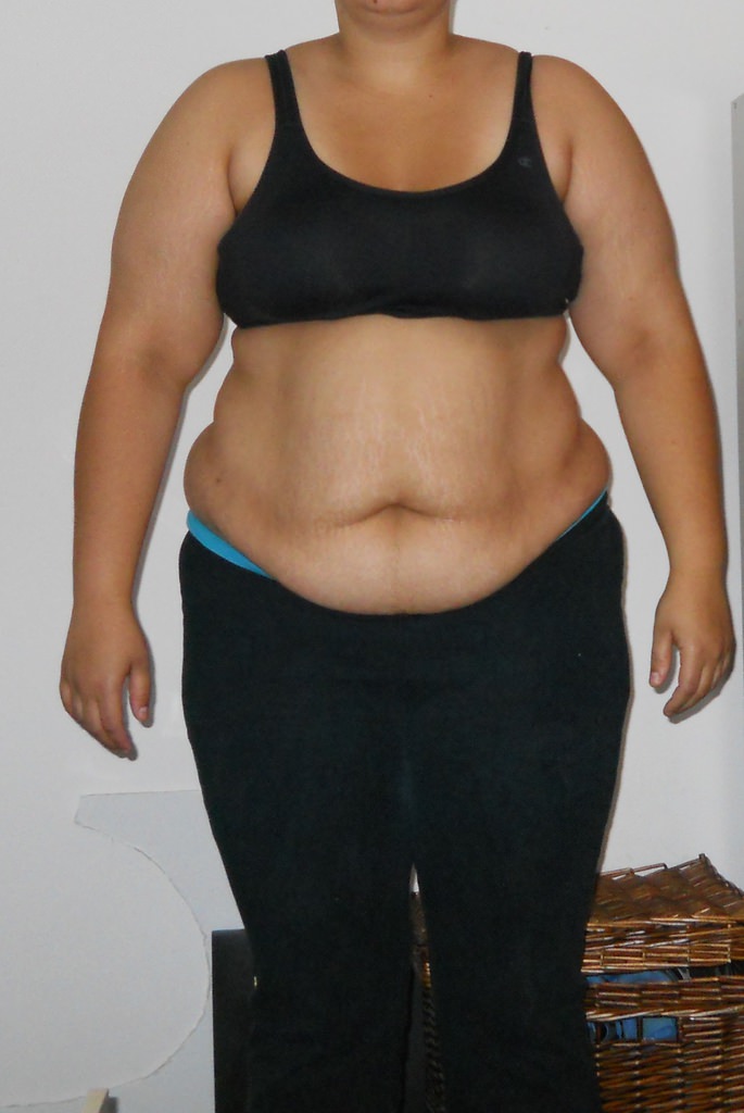 Lipo Fit yöntemi artık Türkiye’de