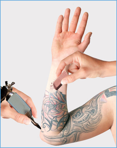 İstenmeyen dövmeler için lazer teknolojisi
