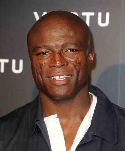 Ünlülerin fiziksel kusurları