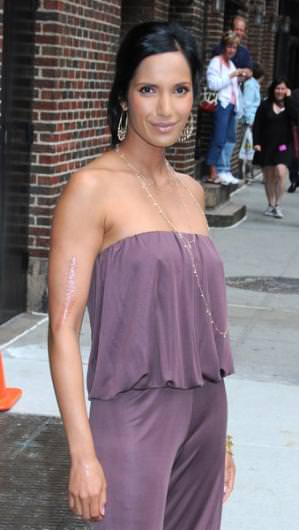 Ünlülerin fiziksel kusurları