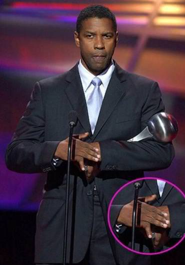 Ünlülerin fiziksel kusurları